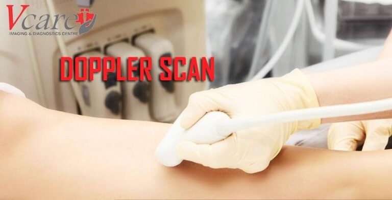 What is a Doppler Scan? Heart Matters