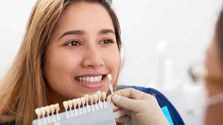 How To Select The Best Veneers For Your Face?