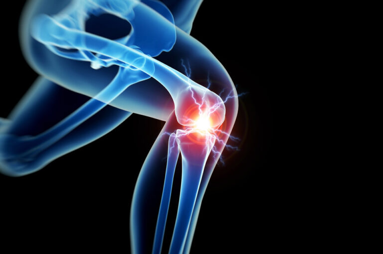 What is the recovery period after a joint replacement?