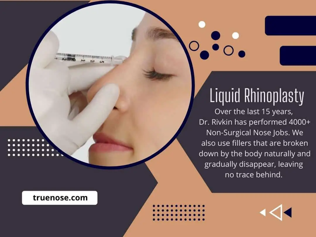 Liquid Rhinoplasty-70a745ee