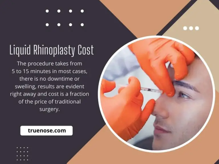 Liquid rhinoplasty cost