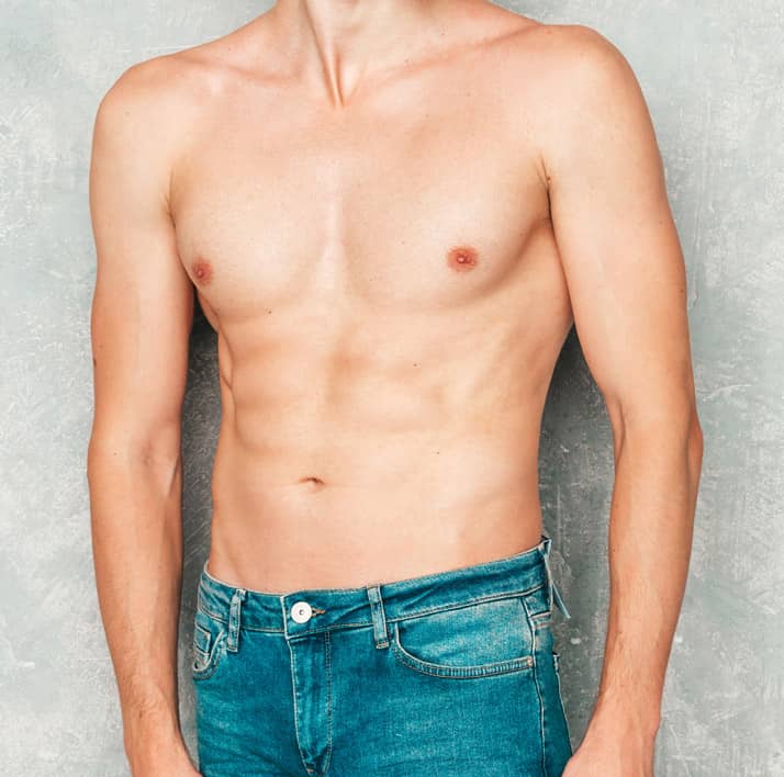 5 Amazing Benefits of Gynecomastia Surgery