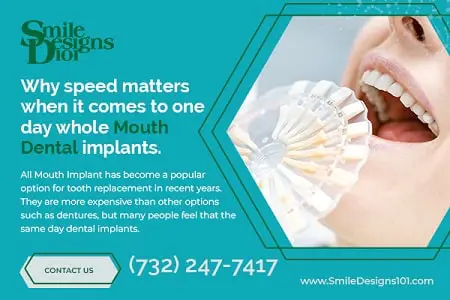 Why speed matters when it comes to one day whole mouth dental implants