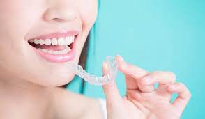 Have You Understood the Invisalign Treatment?