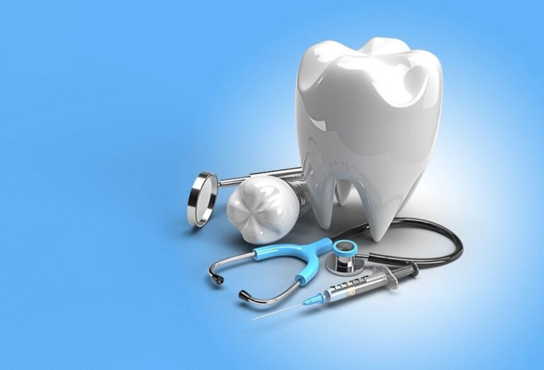 6 Top Advantages Of Having Dental Implants