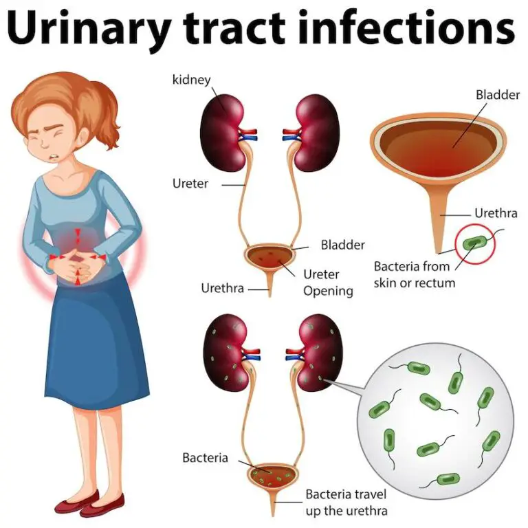 Why Treating Urinary Incontinence is so Important