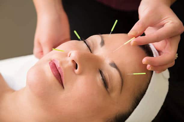 How Cosmetic Acupuncture Can Improve Your Skin!