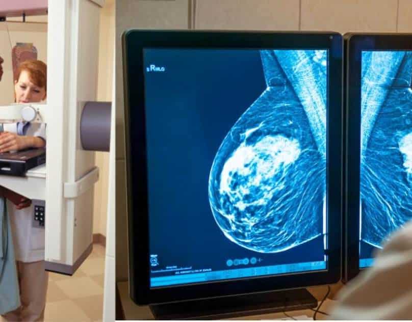 mammogram small-32b0bd51