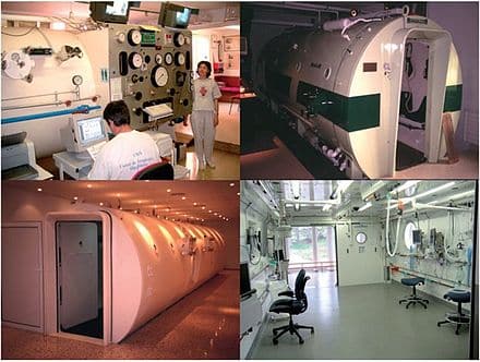 Global Mobile Hyperbaric Chamber Market growth projection to 18.80% CAGR through 2030