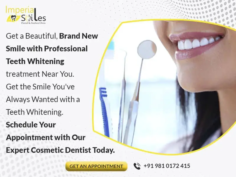 Teeth Whitening Clinic in Gurgaon-57263c45