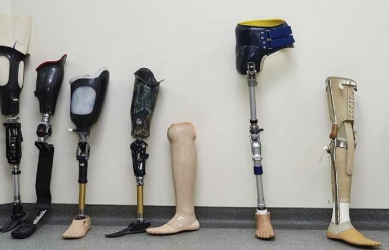 Above Knee Prosthetics Market Growing at a CAGR of 5.95% during forecast period 2030