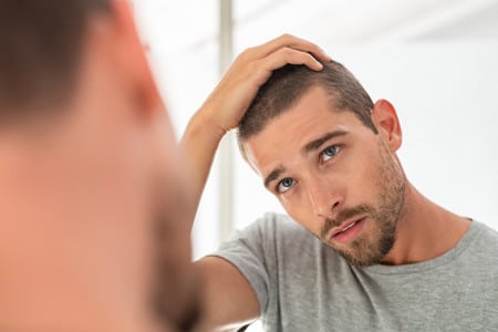 Is there Any Treatment to Recover Baldness?