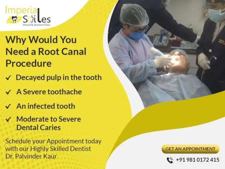 How Do You Know If You Need A Root Canal Treatment