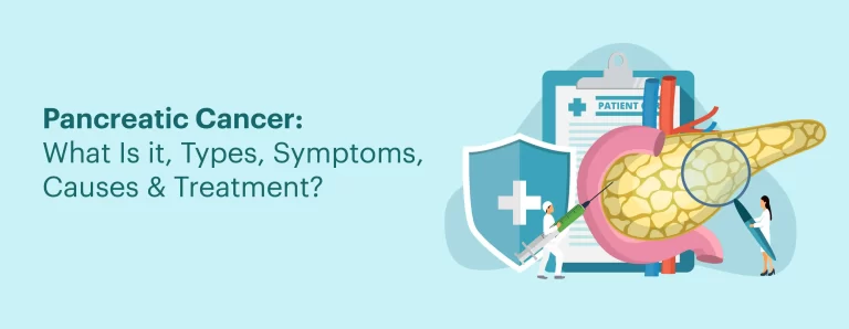 Pancreatic Cancer: What Is It, Types, Symptoms, Causes & Treatment?