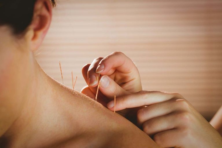 How Does Acupuncture Works And What Are Its Benefits