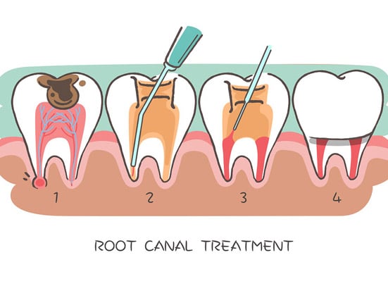 Why do patients have to visit cosmetic dentistry services soon?