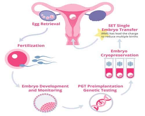 What to expect after an IVF cycle: Pregnancy and Beyond