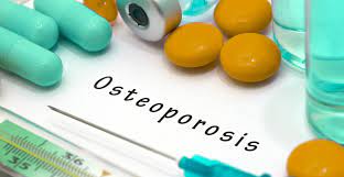 Anti-Osteoporosis Therapy and Fracture Healing Market Analysis, Challenges, Growth and Forecast By 2030