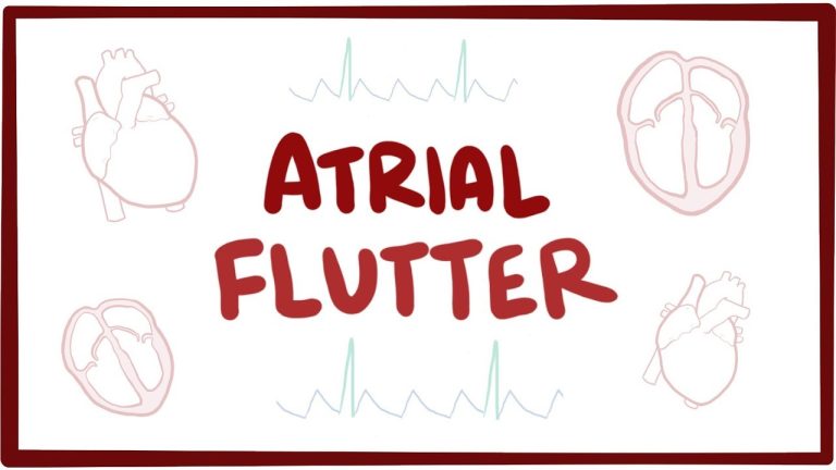 Atrial Flutter Market Report: Size, Growth, Share, Key Players, and Outlook