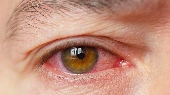 Dry Eye Disease Market Generated Opportunities, Future Scope 2023-2028