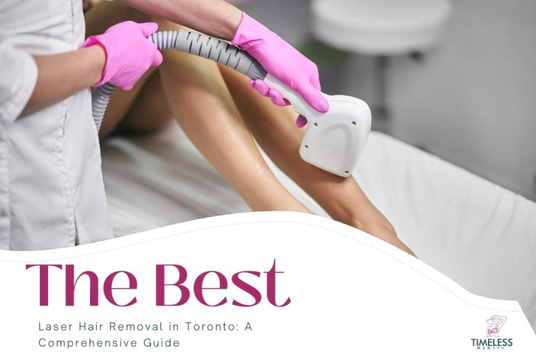 The Best Laser Hair Removal in Toronto: A Comprehensive Guide