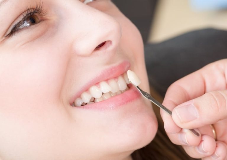 Enhancing Teeth: Cosmetic Dentistry