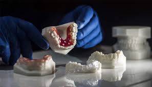 Dental 3D Printing Market Analysis, Challenges, Growth and Forecast By 2030