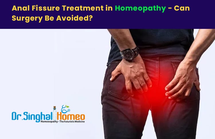 Anal Fissure Treatment in Homeopathy – Can Surgery Be Avoided?