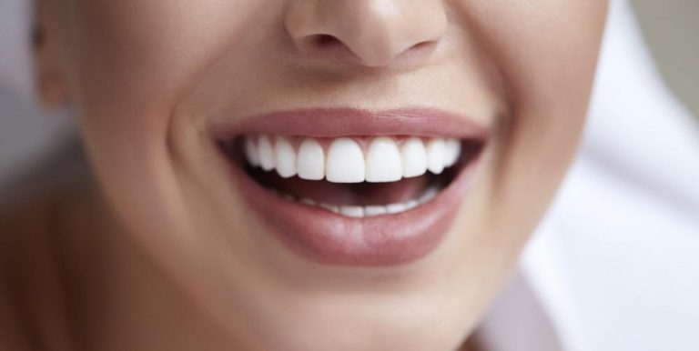 How to Boost Your Confidence with Full Mouth Dental Implants in Calera, AL