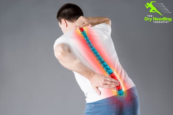 Back Pain Treatment Essex