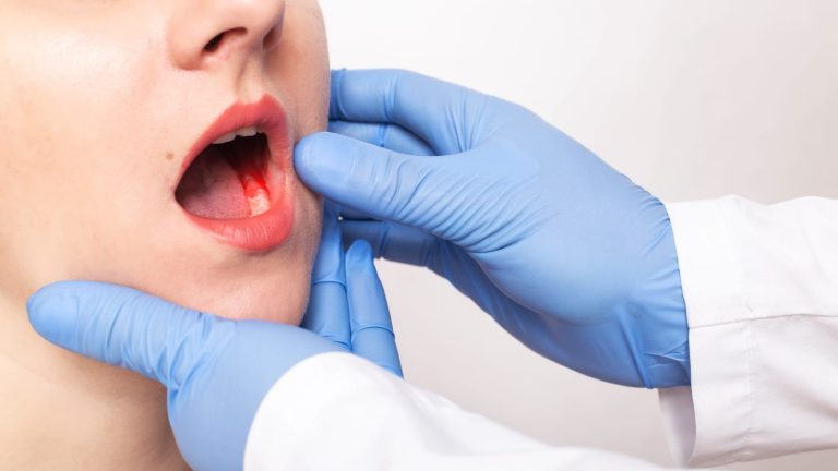 Oral Cancer Treatment Market Report 2023-2028: Size, Growth, and Forecast