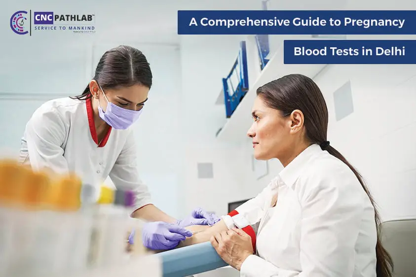 a-comprehensive-guide-to-pregnancy-blood-tests-in-delhi-shortkro