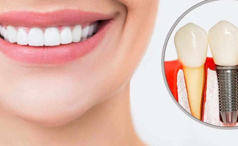 Transform Your Smile With These Best Dental Services in Sutton