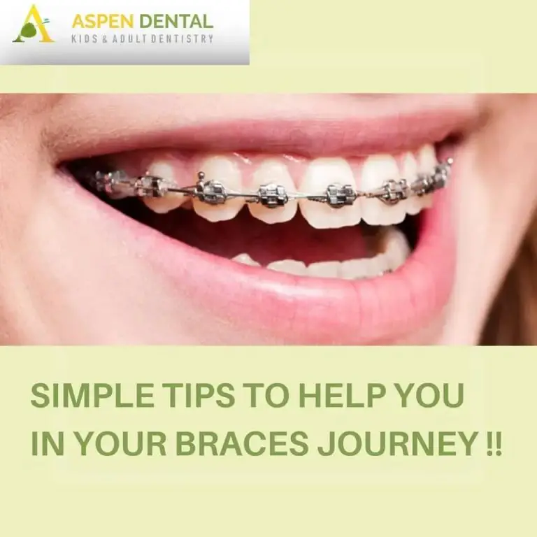 Metal Braces- What Concerns Can They Correct?