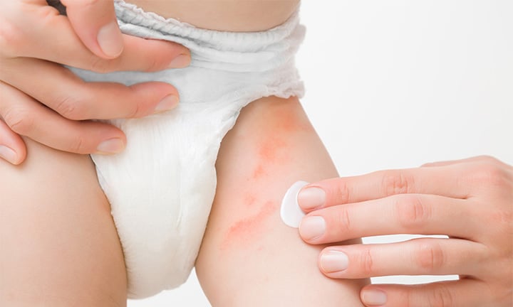 Baby Diaper Rash Creams Market Major Players, Analysis and Forecast till 2016-2028