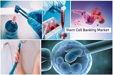 Global Stem Cell Banking Market Outlook to 2028: Ken Research