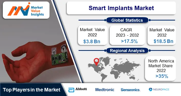 Smart Implants Market | Regional Analysis and Industry Trends, 2023-2032