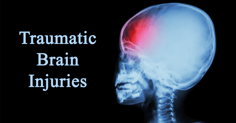 Surviving the Storm Navigating Traumatic Brain Injury in Honolulu