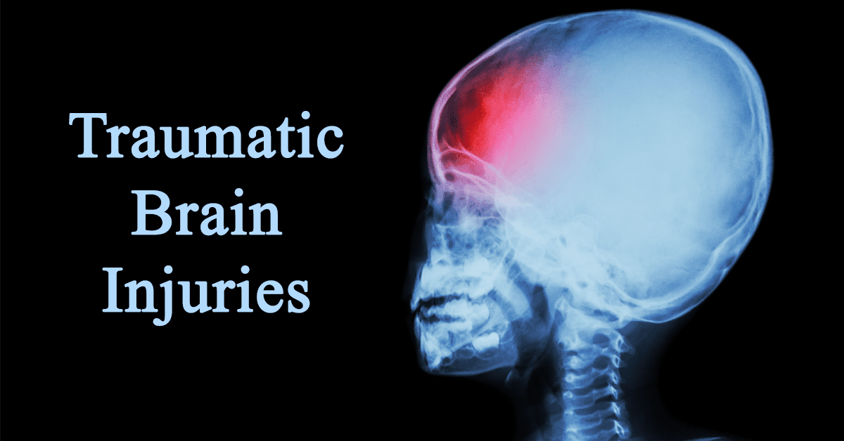 Traumatic Brain Injury-min (1)