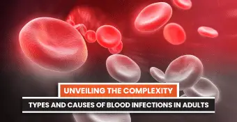 Unveiling the Complexity: Types and Causes of Blood Infections in Adults