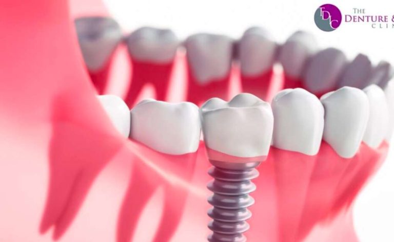 Discover Excellence in Dental Care Across Various Locations with The Denture and Implant Clinic