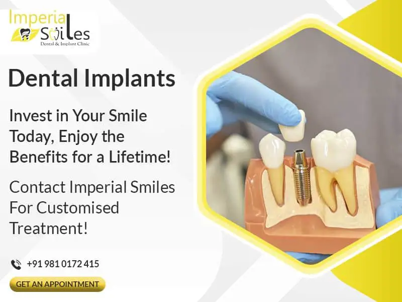 Dental Implants in Gurgaon