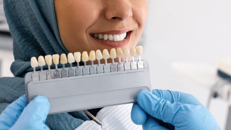 Dental Veneers: How They Enhance Your Smile