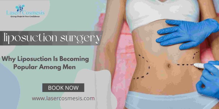Why Liposuction Is Becoming Popular Among Men