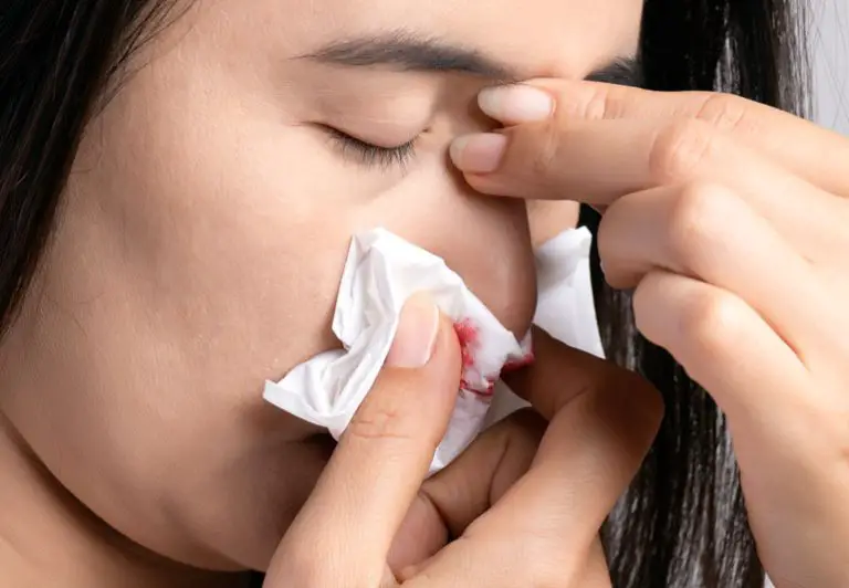 Tips for Stopping a Nosebleed Fast