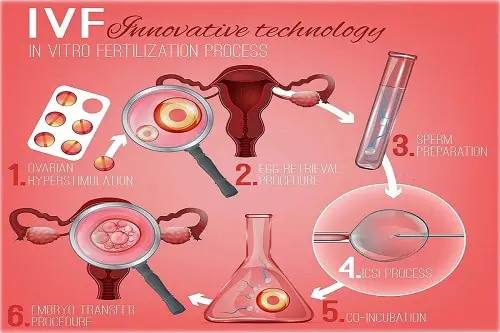 Exploring IVF Cost in Bangalore: Factors and Considerations