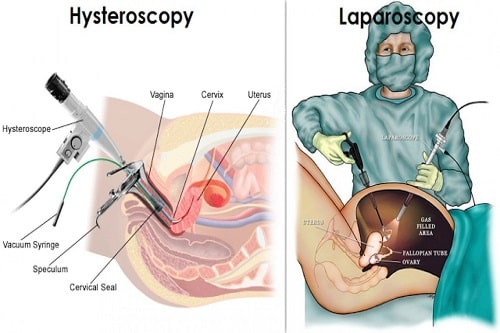 Exploring the Benefits of Hysteroscopy: A Window into Women’s Health