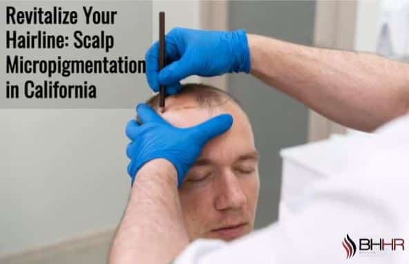 Revitalize Your Hairline: Scalp Micropigmentation in California