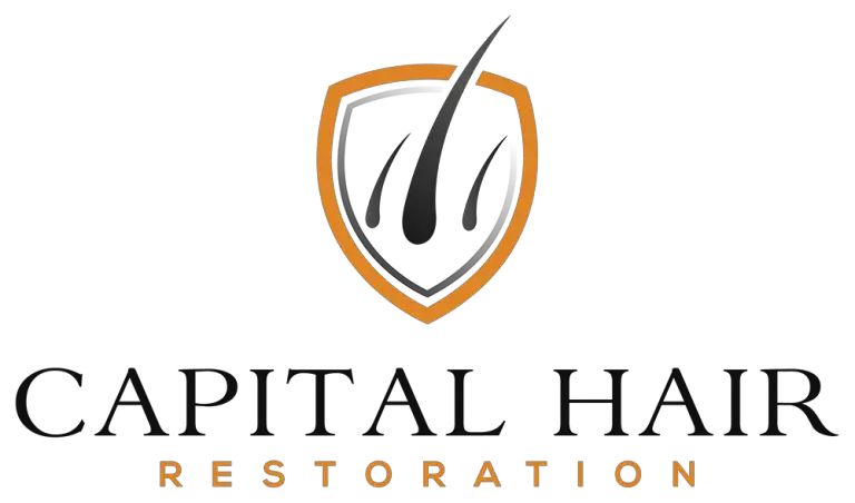 Capital Hair Restoration – Expert Solutions for Hair Loss in the UK