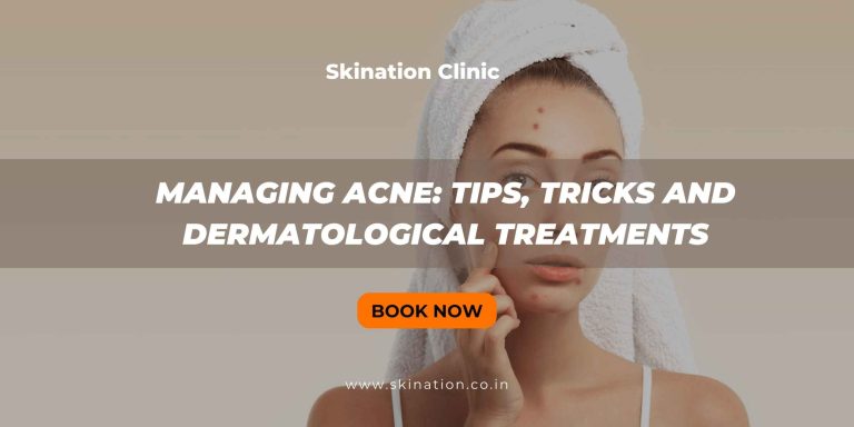 Managing Acne: Tips, Tricks and Dermatological Treatments